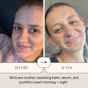 Side-by-side before and after results of a woman using Oak & Sage Cleansing Balm, Radiant Serum, and Youthful Cream morning and night, showing visibly clearer, smoother skin.
