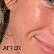 After using Oak & Sage Exfoliating Balm, skin appears smoother, clearer, and more radiant with visibly reduced blemishes.