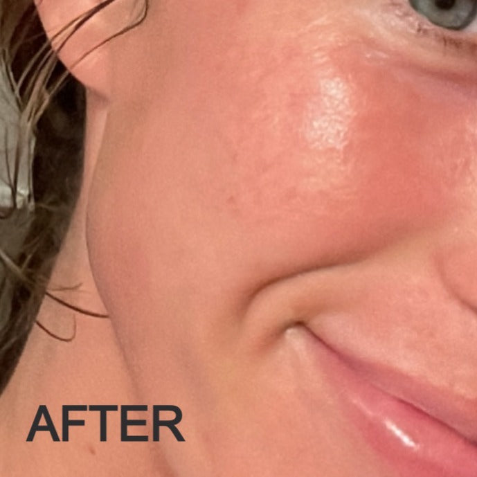 After using Oak & Sage Exfoliating Balm, skin appears smoother, clearer, and more radiant with visibly reduced blemishes.