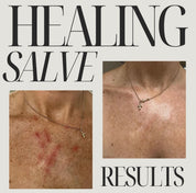 Before and after results of Oak & Sage Healing Salve showing visibly reduced redness and irritation on chest, highlighting natural skin healing benefits