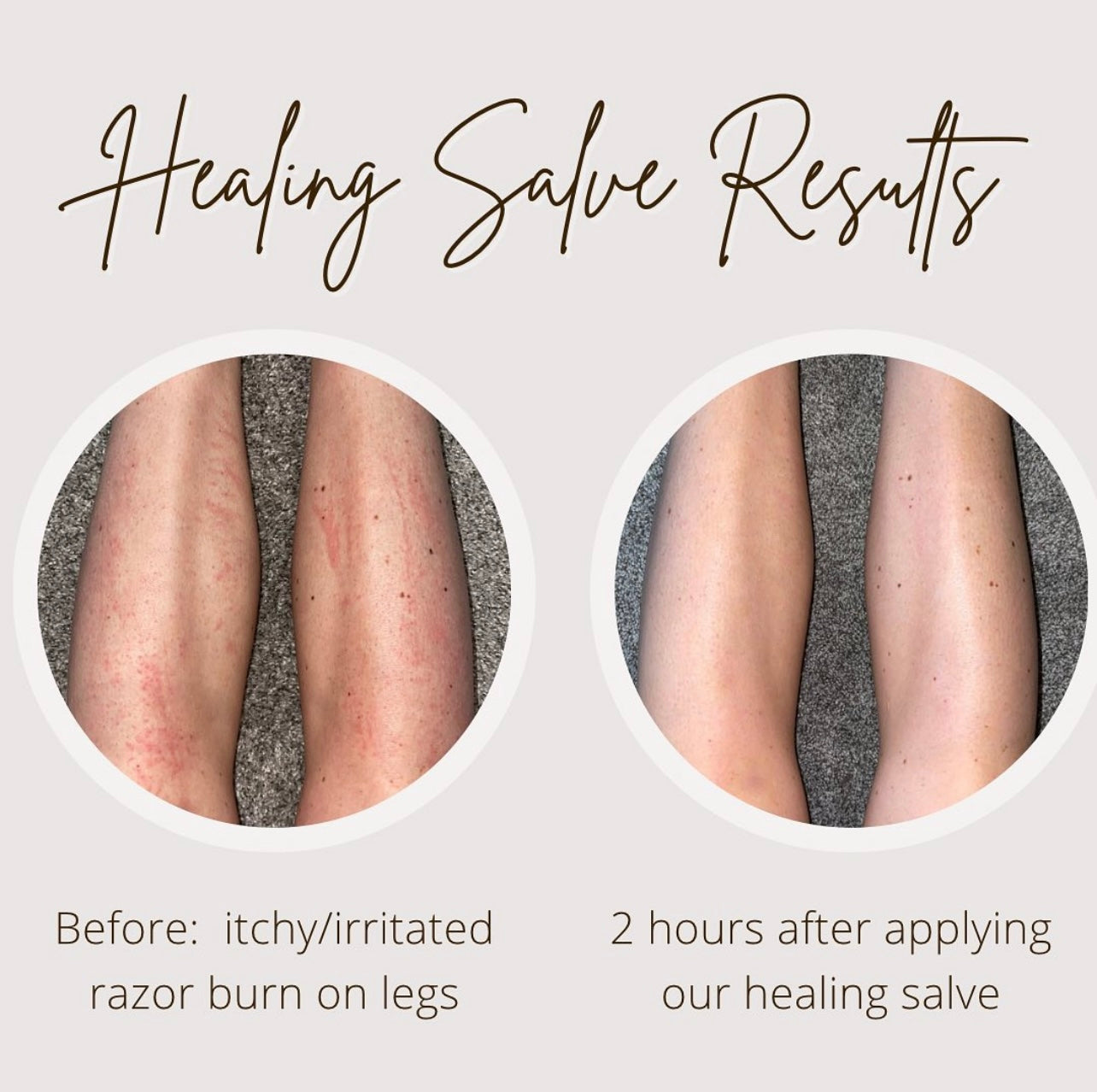 Oak & Sage Healing Salve before-and-after on legs showing reduction in redness and irritation from razor burn within 2 hours of application