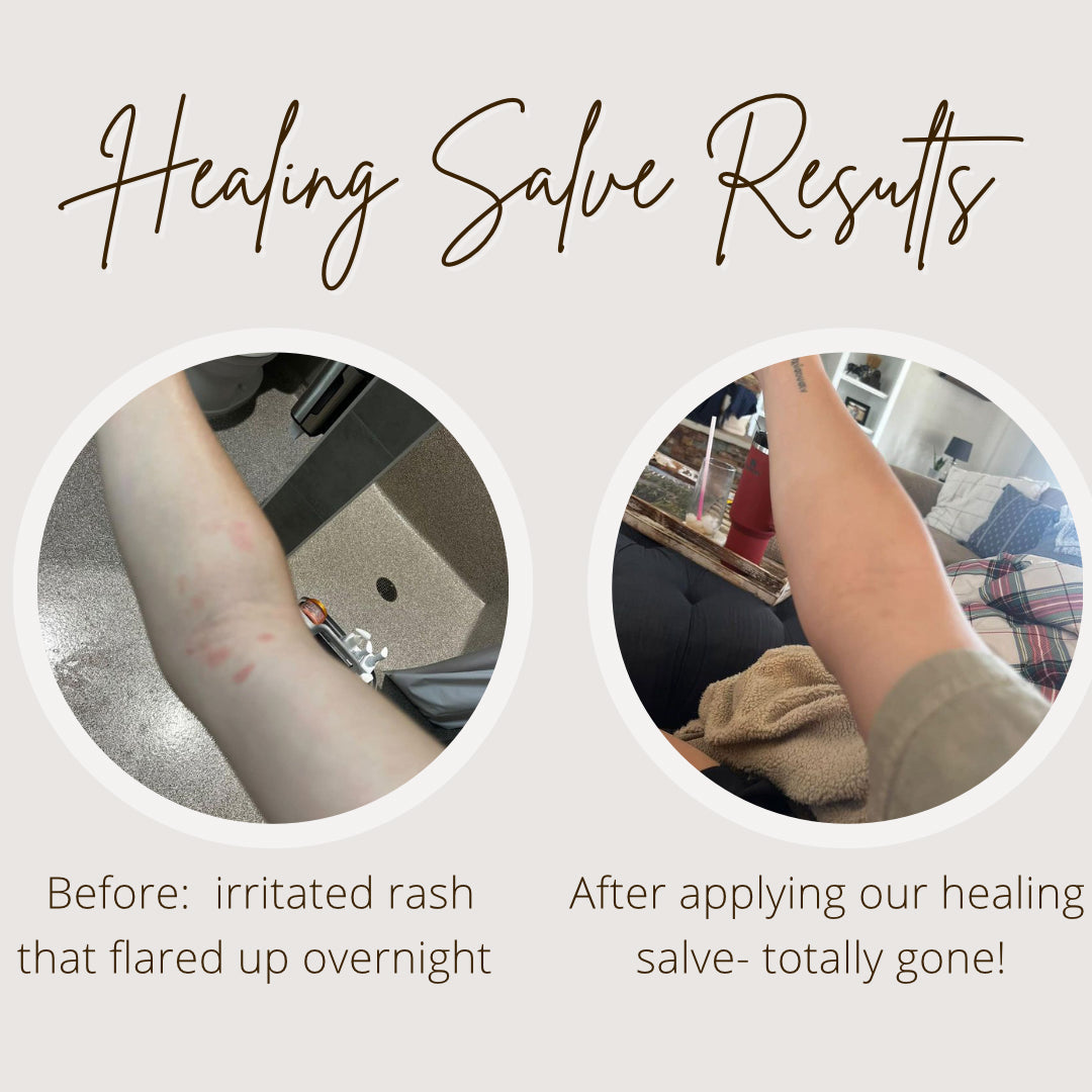 Before-and-after results of Oak & Sage Healing Salve showing complete resolution of overnight irritated rash on forearm after application.
