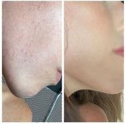 Side-by-side before and after comparison of a woman’s jawline and cheek showing smoother, clearer skin after using Oak & Sage Youthful Cream.