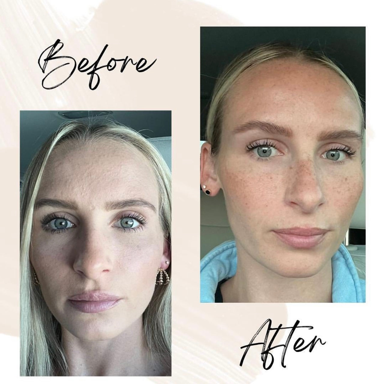 Before and after images of a woman showing visibly improved skin texture, hydration, and brightness after using Oak & Sage Youthful Cream.
