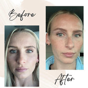 Before and after images of a woman showing visibly improved skin texture, hydration, and brightness after using Oak & Sage Youthful Cream.